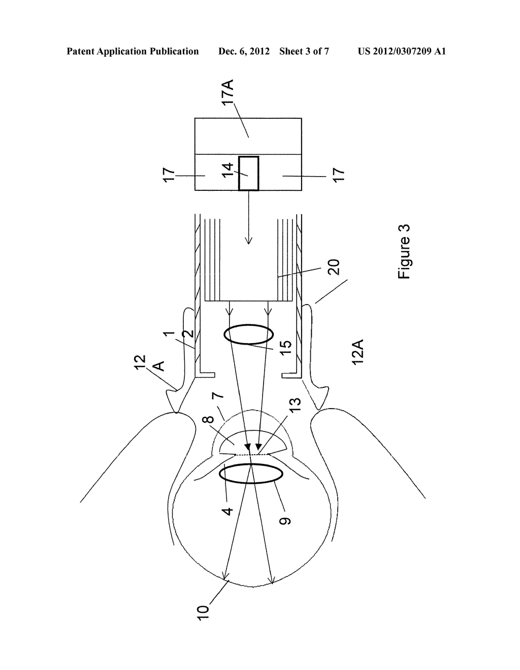 NON-INVASIVE SPECTROPHOTOMETER AND RELATED METHOD - diagram, schematic, and image 04