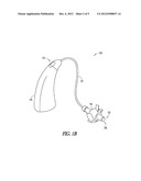 MIXING OF IN-THE-EAR MICROPHONE AND OUTSIDE-THE-EAR MICROPHONE SIGNALS TO     ENHANCE SPATIAL PERCEPTION diagram and image