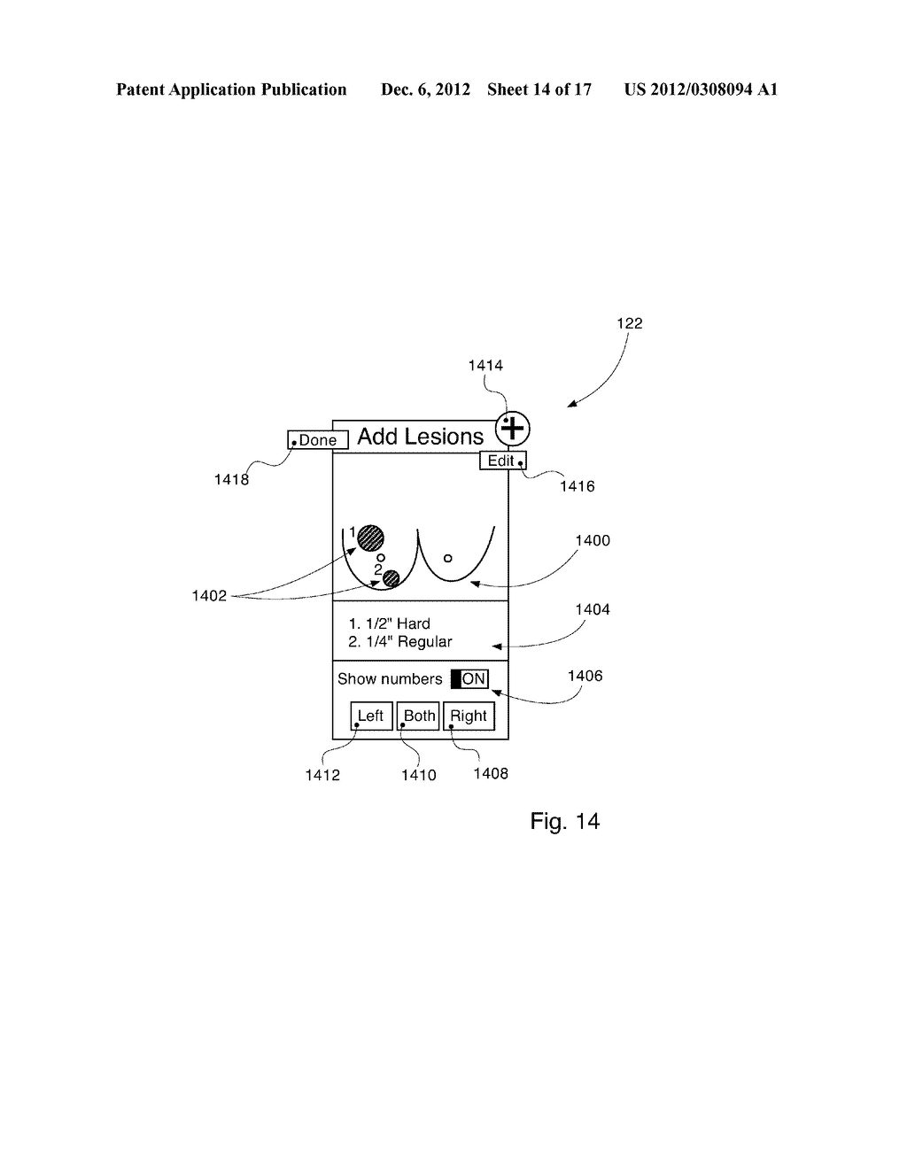 SYSTEM FOR BREAST EXAMINATION RESULT MAPPING, RECORDING, COMPARING, AND/OR     TRACKING - diagram, schematic, and image 15