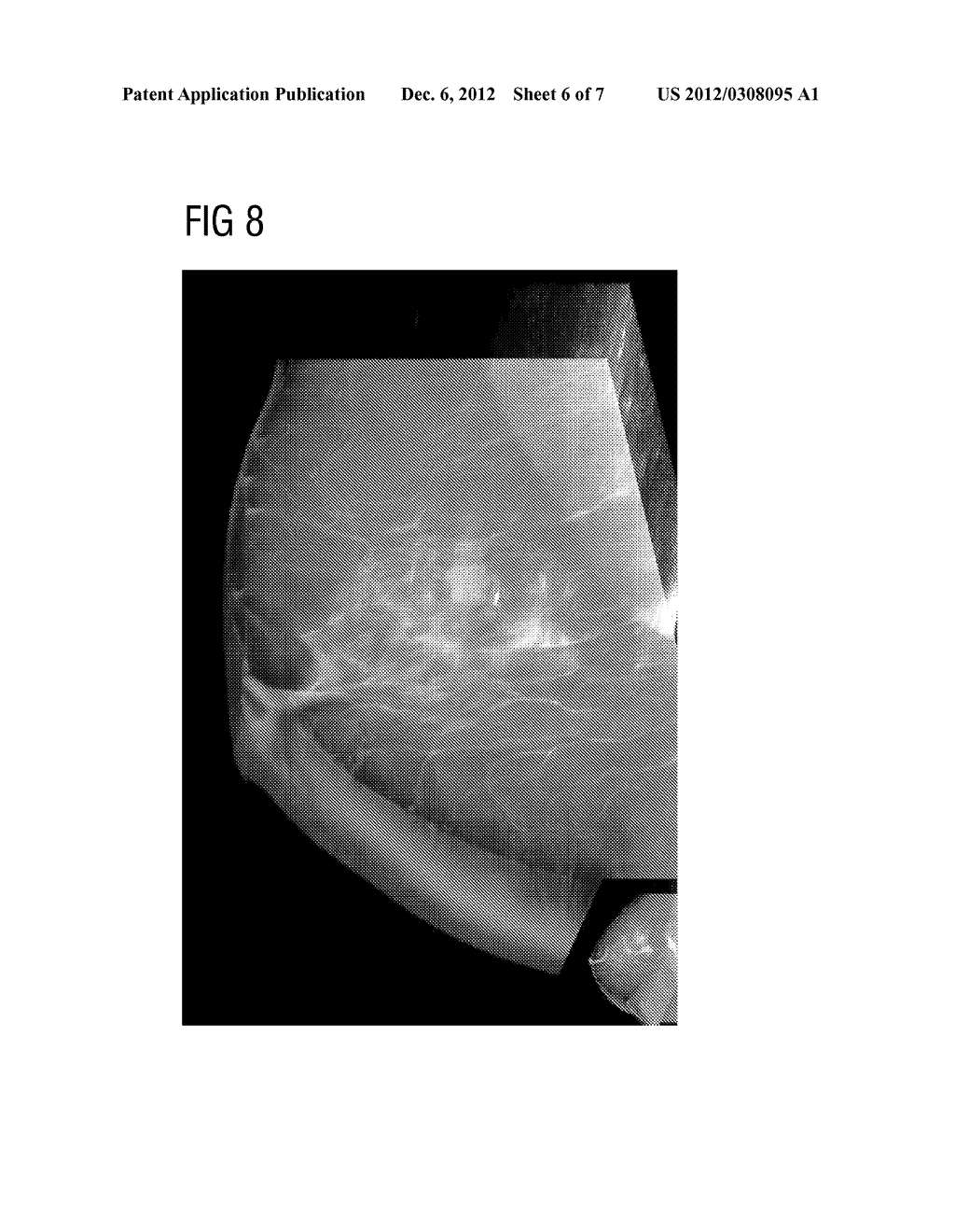 METHOD AND DEVICE FOR ADJUSTING THE VISUALIZATION OF VOLUME DATA OF AN     OBJECT - diagram, schematic, and image 07