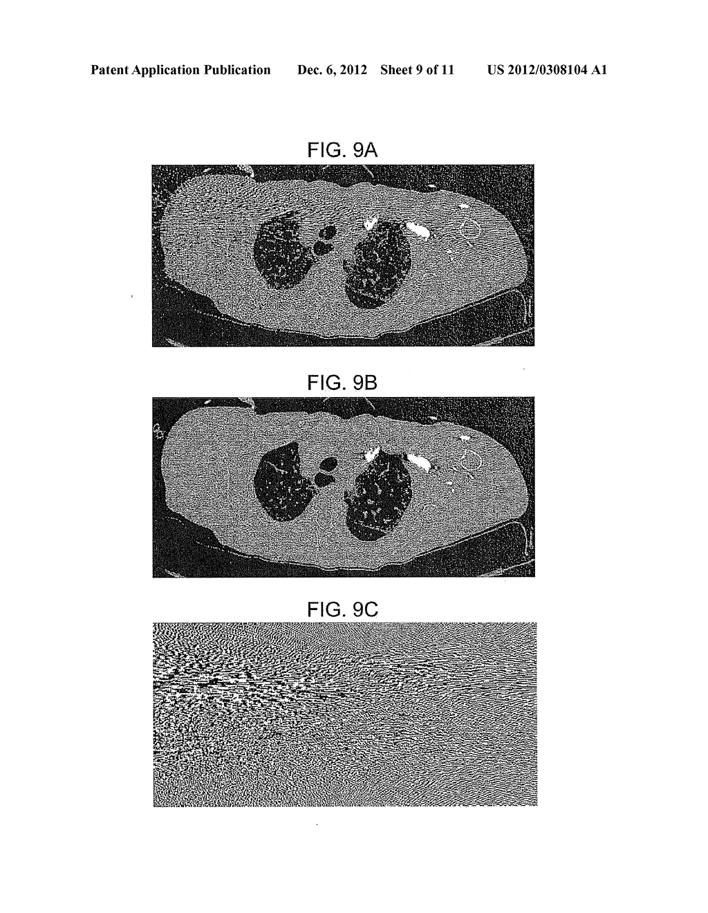 METHOD AND SYSTEM UTILIZING PARAMETER-LESS FILTER FOR SUBSTANTIALLY     REDUCING STREAK AND OR NOISE IN COMPUTER TOMOGRAPHY (CT) IMAGES - diagram, schematic, and image 10