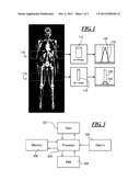 METHOD AND APPARATUS FOR MEASURING ACTIVITY OF A TRACER diagram and image