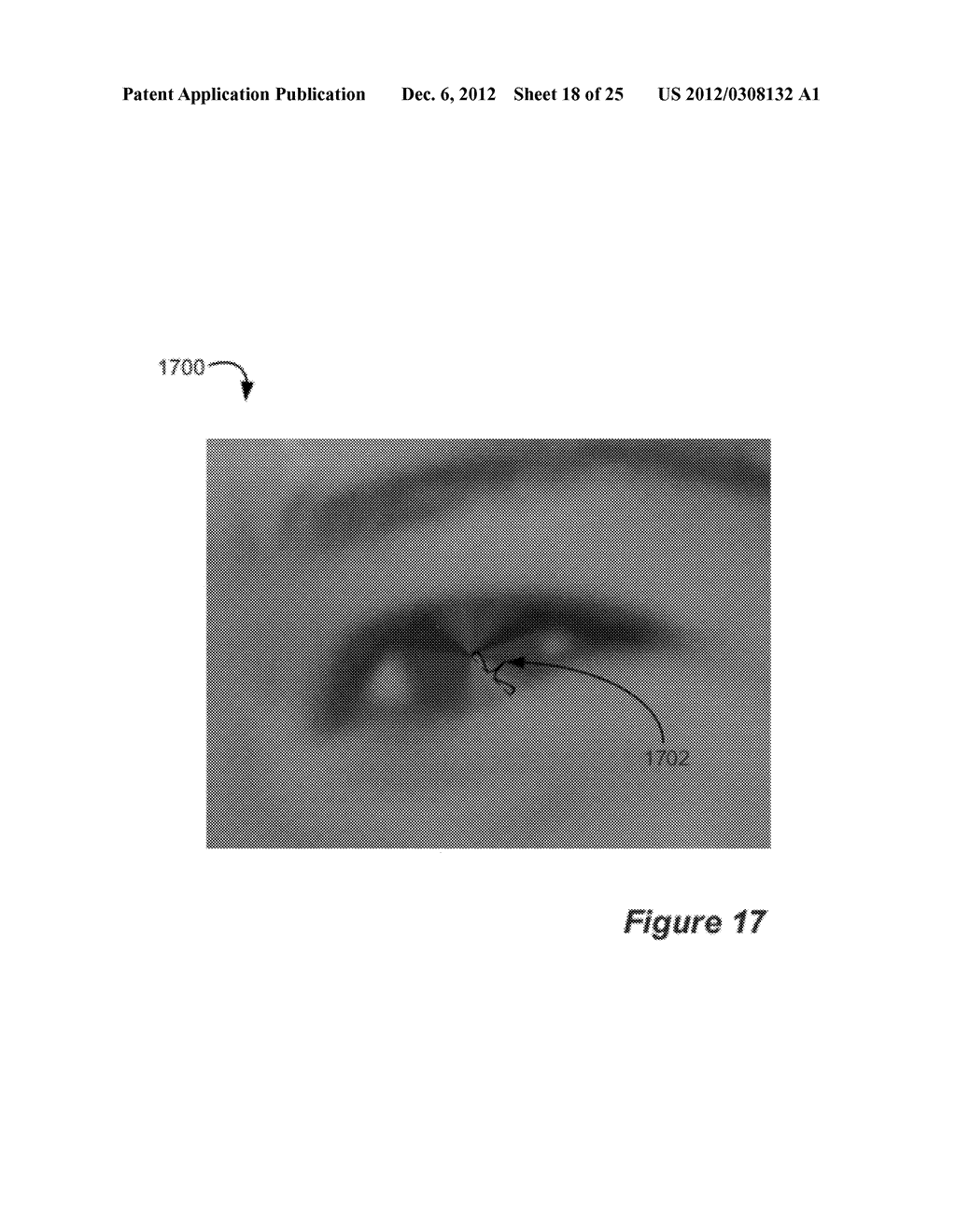 Automatic Red-Eye Repair Using Multiple Recognition Channels - diagram, schematic, and image 19