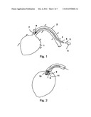 PUMP DEVICE HAVING A DETECTION DEVICE diagram and image