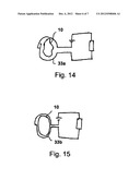 PUMP DEVICE HAVING A DETECTION DEVICE diagram and image
