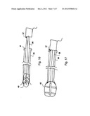 PUMP DEVICE HAVING A DETECTION DEVICE diagram and image