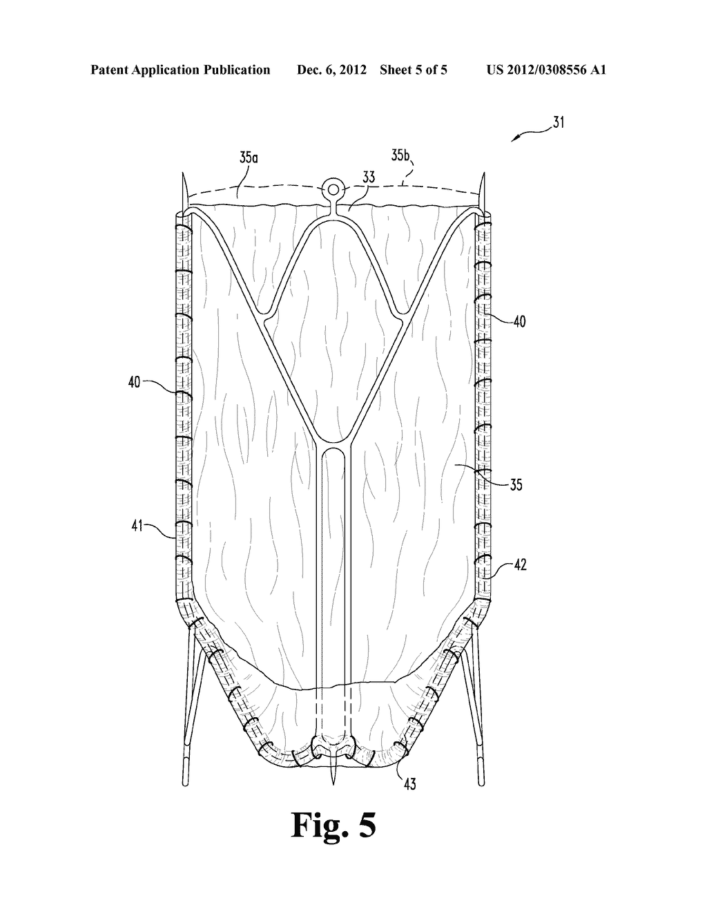 PROCESSED ECM MATERIALS WITH ENHANCED COMPONENT PROFILES - diagram, schematic, and image 06