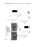 USE OF TYROSINE KINASE INHIBITORS FOR TREATMENT OF PROLACTINOMA diagram and image