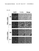 PHARMACEUTICAL COMPOSITION FOR INHIBITING ABNORMAL PROLIFERATION OF CELLS diagram and image