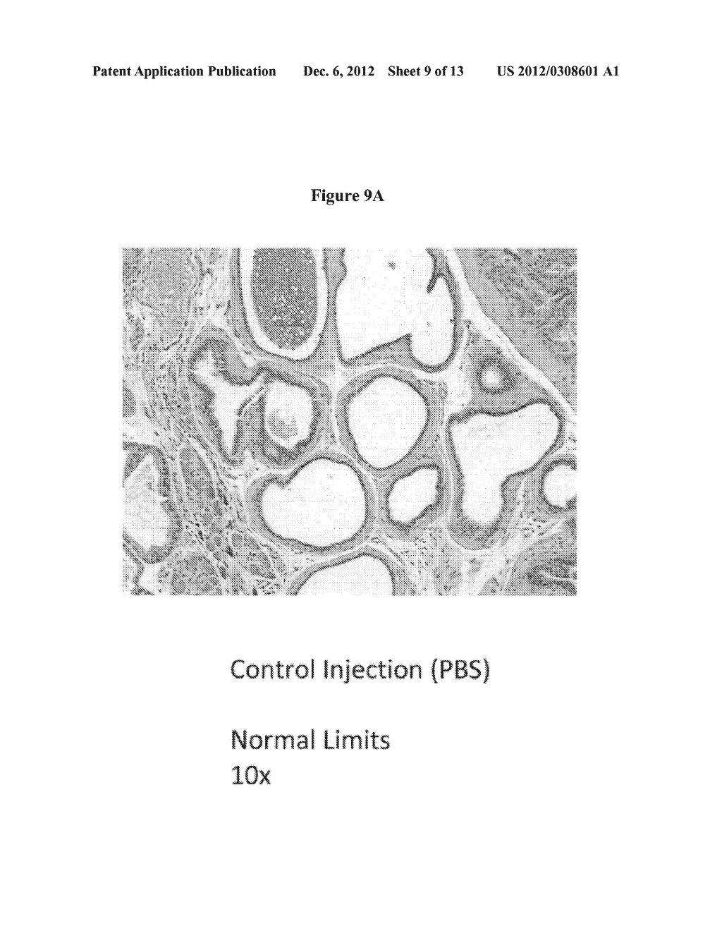 METHODS AND MATERIALS FOR TREATING CANCER - diagram, schematic, and image 10