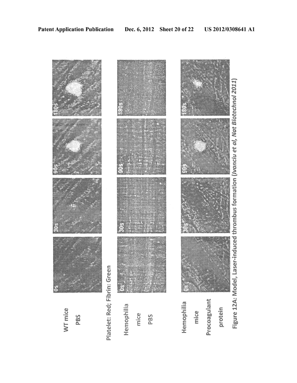 Compositions and Methods for Enhancing Coagulation Factor VIII Function - diagram, schematic, and image 21