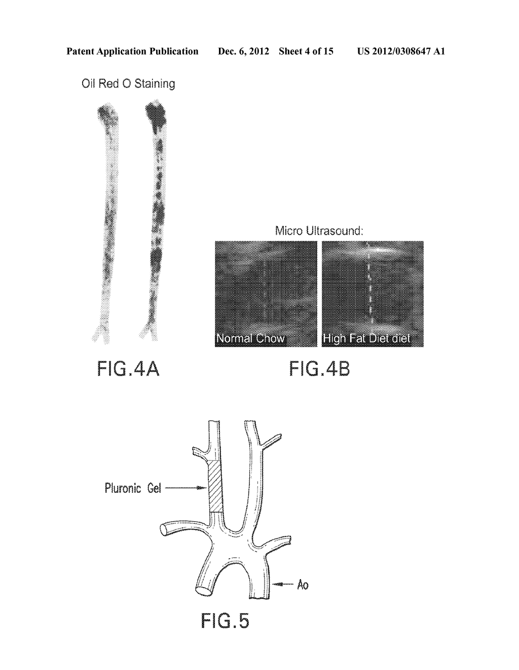 USE OF MIR-30E TO TREAT VASCULAR LESIONS - diagram, schematic, and image 05