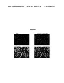 MAGNETIC NANOSTRUCTURES AS THERANOSTIC AGENTS diagram and image