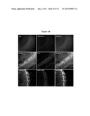 MAGNETIC NANOSTRUCTURES AS THERANOSTIC AGENTS diagram and image