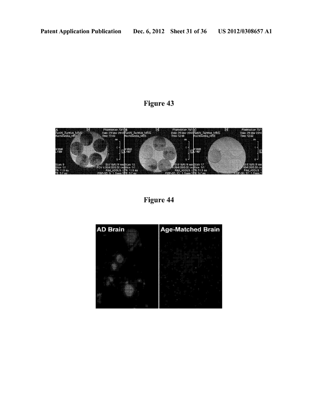 MAGNETIC NANOSTRUCTURES AS THERANOSTIC AGENTS - diagram, schematic, and image 32