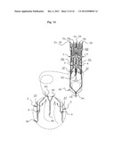 RICH-LEAN COMBUSTION BURNER diagram and image