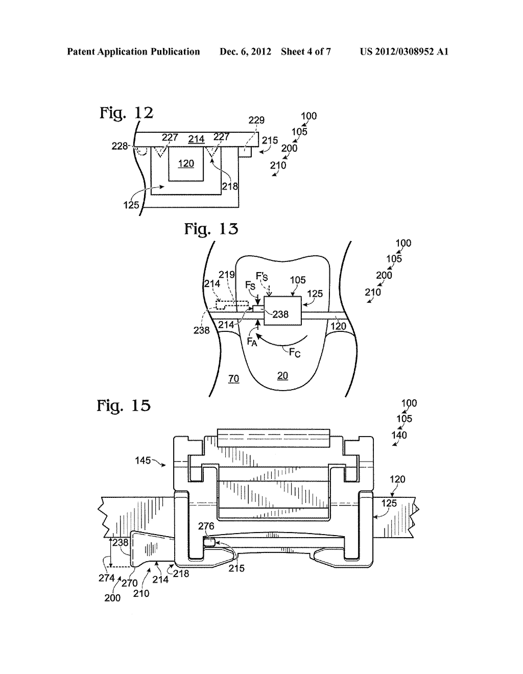 PRESCRIPTION-ALTERING ACCESSORIES FOR ORTHODONTIC BRACKETS, AND     ORTHODONTIC BRACKET ASSEMBLIES INCLUDING THE SAME - diagram, schematic, and image 05