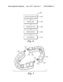 DENTAL MODELS USING STEREOLITHOGRAPHY diagram and image