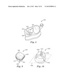 DENTAL MODELS USING STEREOLITHOGRAPHY diagram and image