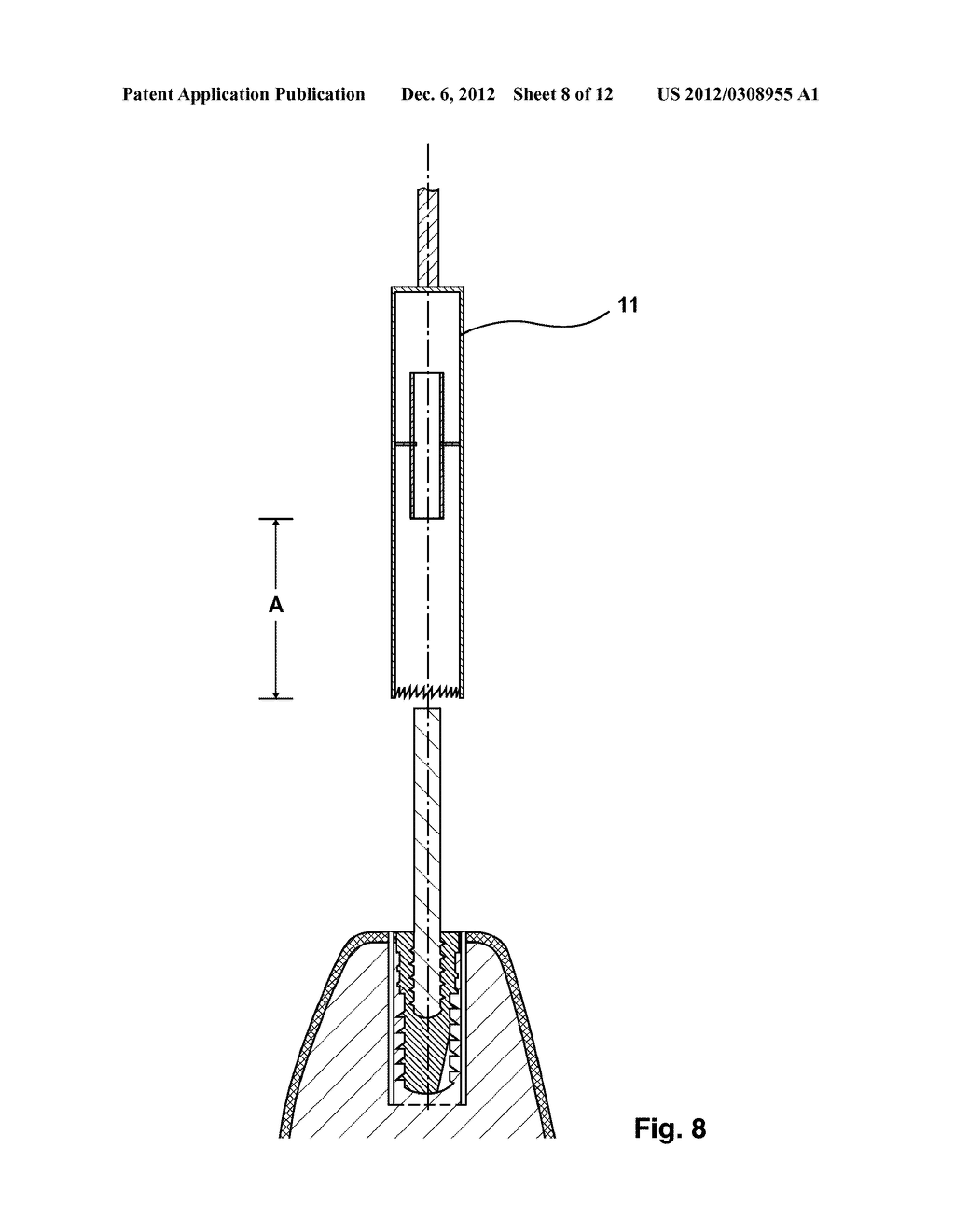 APPARATUS FOR EXPLANTING A DENTAL IMPLANT FROM A HUMAN OR ANIMAL BONE - diagram, schematic, and image 09