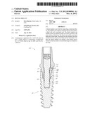 DENTAL IMPLANT diagram and image