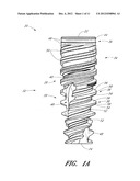 DENTAL IMPLANT diagram and image