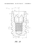 DENTAL IMPLANT diagram and image