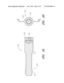 DENTAL IMPLANT diagram and image