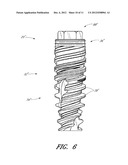 DENTAL IMPLANT diagram and image