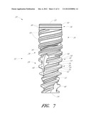 DENTAL IMPLANT diagram and image