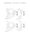 DENTAL DIAGNOSIC AND DENTAL RESTORATION METHODS, SYSTEMS, APPARATUSES, AND     DEVICES diagram and image