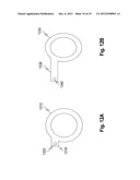 DENTAL DIAGNOSIC AND DENTAL RESTORATION METHODS, SYSTEMS, APPARATUSES, AND     DEVICES diagram and image