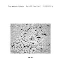 DETECTION OF UNHEALTHY BONE MARROW-DERIVED CELL FOR DISEASE     PREDISPOSITIONS diagram and image