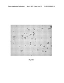 DETECTION OF UNHEALTHY BONE MARROW-DERIVED CELL FOR DISEASE     PREDISPOSITIONS diagram and image