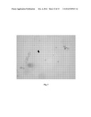 DETECTION OF UNHEALTHY BONE MARROW-DERIVED CELL FOR DISEASE     PREDISPOSITIONS diagram and image