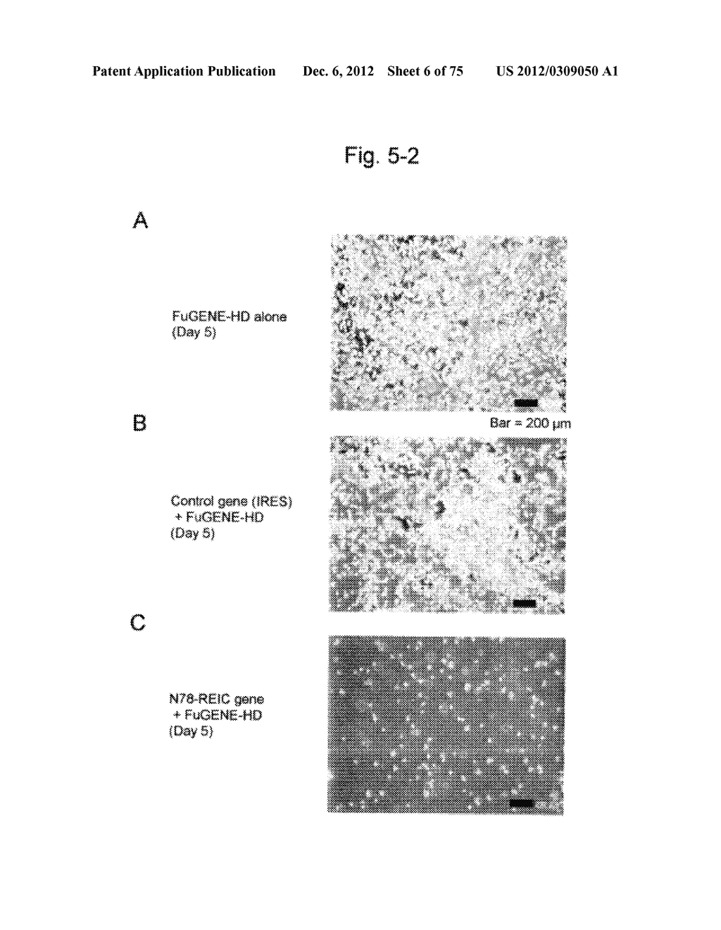 SYSTEM FOR INCREASING GENE EXPRESSION AND VECTOR COMPRISING THE SYSTEM - diagram, schematic, and image 07