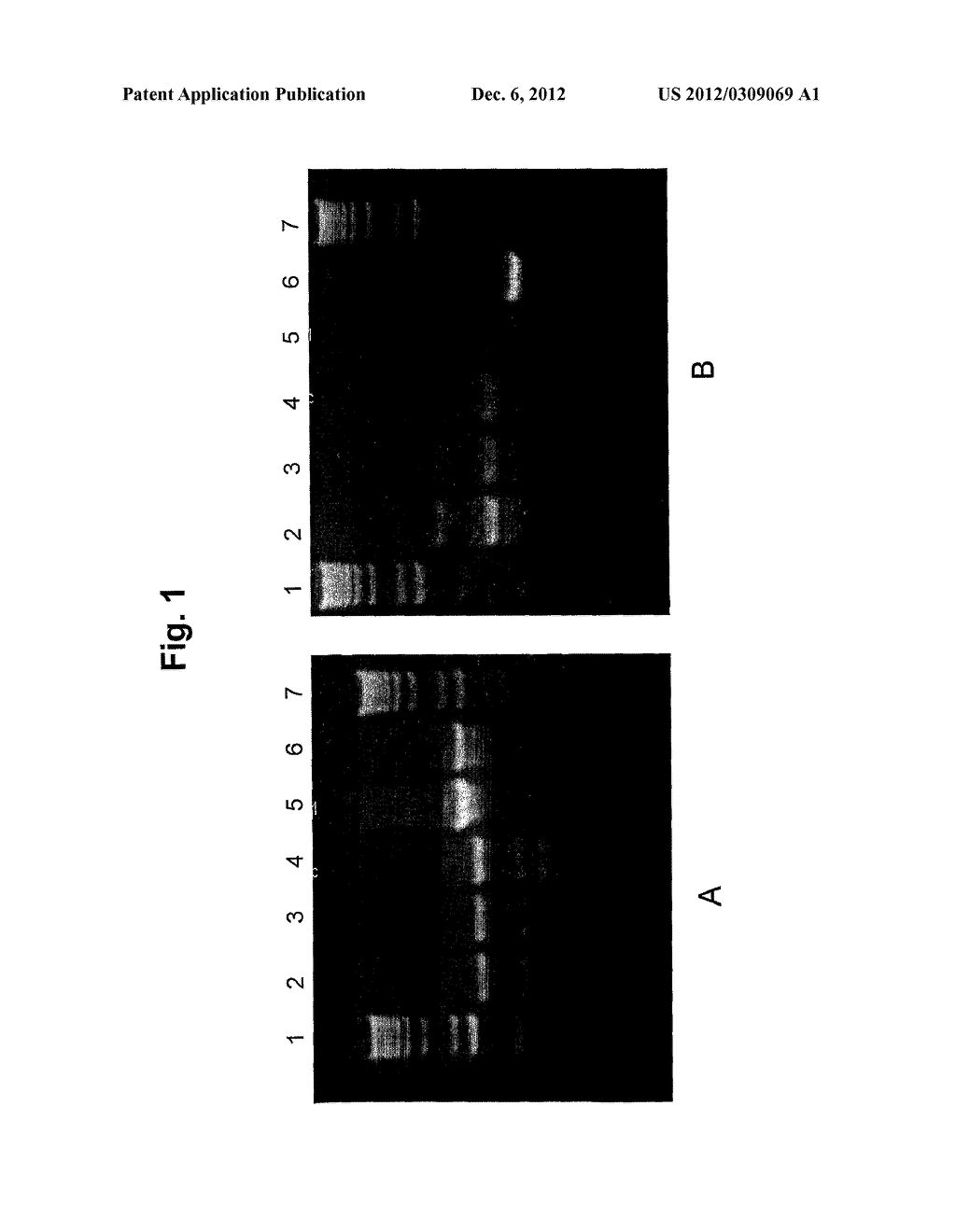 Yeast for Fermentation - diagram, schematic, and image 02