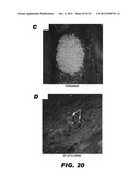 COMPOUNDS AND METHODS FOR TREATING BACTERIAL INFECTIONS diagram and image