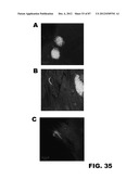 COMPOUNDS AND METHODS FOR TREATING BACTERIAL INFECTIONS diagram and image