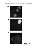 COMPOUNDS AND METHODS FOR TREATING BACTERIAL INFECTIONS diagram and image