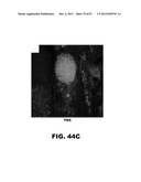 COMPOUNDS AND METHODS FOR TREATING BACTERIAL INFECTIONS diagram and image