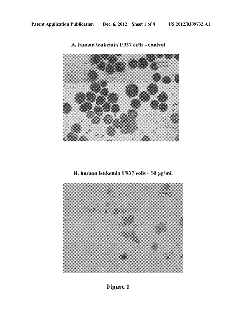 METHOD FOR INHIBITION OF TUMOR CELL GROWTH USING     (22R)-5alpha-LANOSTA-8,24-DIEN-3Beta,15alpha,21-TRIOL - diagram, schematic, and image 02