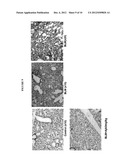 METHODS OF TREATING FIBROTIC DISEASES USING TETRAHYDROCANNABINOL-11-OIC     ACIDS diagram and image