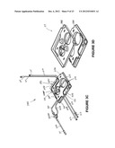 SHIELDING ASSEMBLIES FOR INFUSION SYSTEMS diagram and image