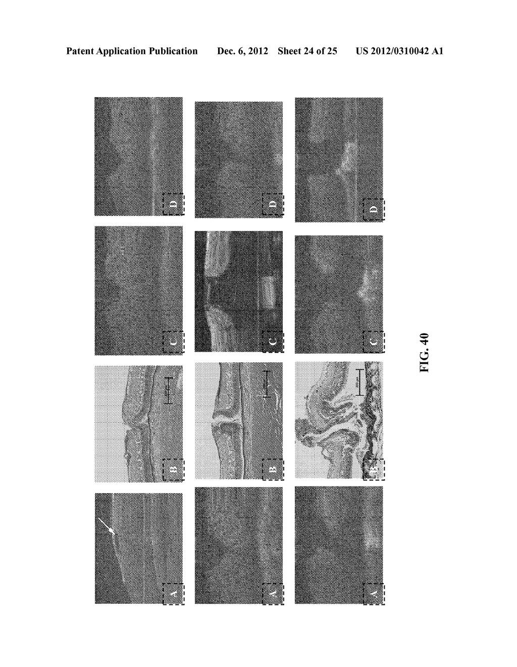 APPARATUS AND METHOD FOR REAL-TIME IMAGING AND MONITORING OF AN     ELECTROSURGICAL PROCEDURE - diagram, schematic, and image 25