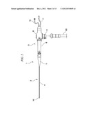 ELECTRONIC ENDOSCOPE diagram and image