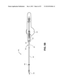 SYSTEMS FOR REDUCING FLUID LEAKAGE AND SPRAY-BACK FROM ENDOSCOPIC MEDICAL     PROCEDURES diagram and image