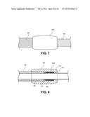 SYSTEMS FOR REDUCING FLUID LEAKAGE AND SPRAY-BACK FROM ENDOSCOPIC MEDICAL     PROCEDURES diagram and image