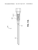 SYSTEMS FOR REDUCING FLUID LEAKAGE AND SPRAY-BACK FROM ENDOSCOPIC MEDICAL     PROCEDURES diagram and image