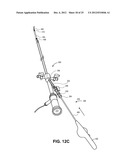 SYSTEMS FOR REDUCING FLUID LEAKAGE AND SPRAY-BACK FROM ENDOSCOPIC MEDICAL     PROCEDURES diagram and image